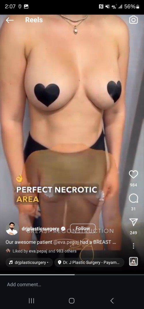 Screenshot_20240708_140755_Instagram04ac78926e270d75.jpg
